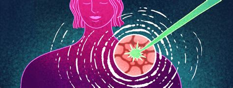 Radiation Therapy for Skin Cancer: How and Why It Works