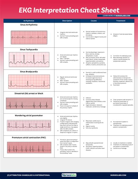 EKG Interpretation Cheat Sheet (Free Download) | Ekg interpretation ...