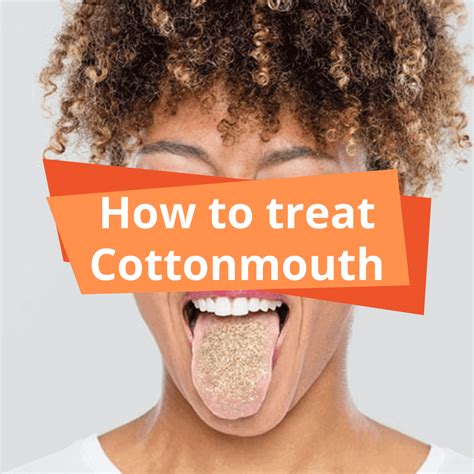 How to Treat Cottonmouth - SacredMeds