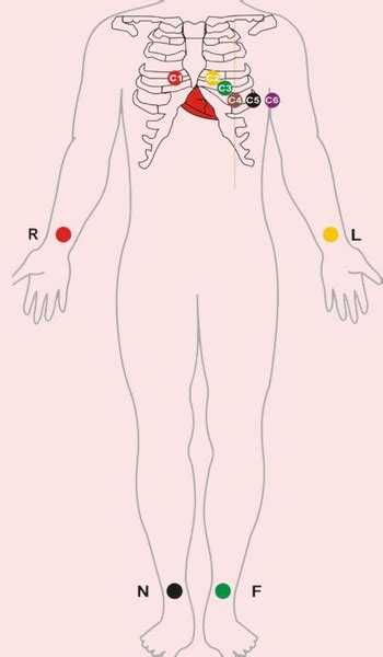 12 Lead Ecg Placement Mnemonic