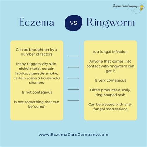 Ringworm Versus Eczema