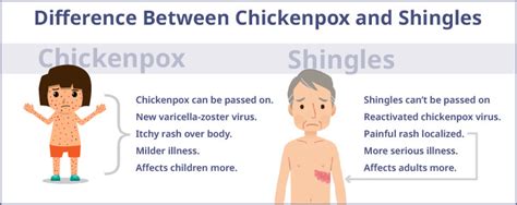 Shingles in Mouth– Symptoms, Causes & Homeopathic Medicines