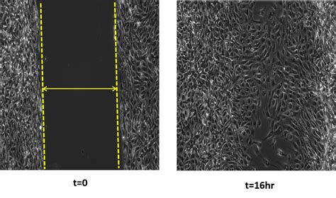 Imaging and Analyzing Your Wound Healing Assay