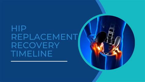 Hip Replacement Recovery Timeline - Dr Sartawi