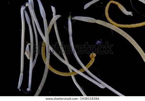 Study Acanthocephala Phylum Parasitic Worms Known Stock Photo (Edit Now ...