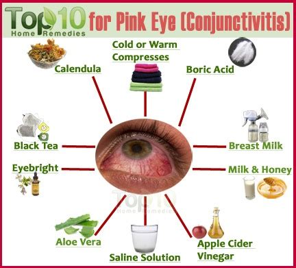 Home Remedies for Pink Eye (Conjunctivitis) | Top 10 Home Remedies