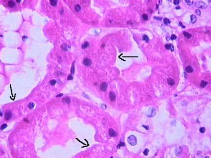 Histology tubules