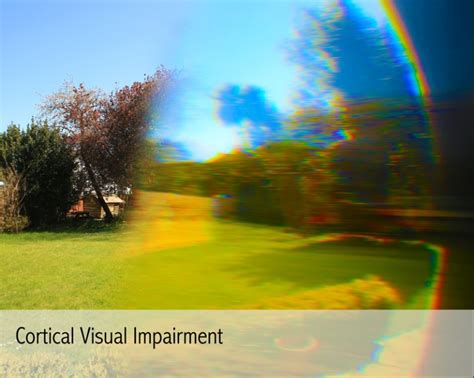 Cortical Visual Impairment - 4Sight Vision Support