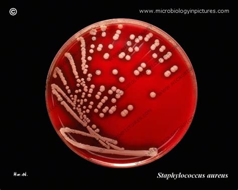 Staphylococcus aureus on sheep blood agar.