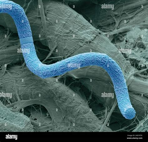 Spirulina cyanobacteria. Scanning electron micrograph (SEM, image ...