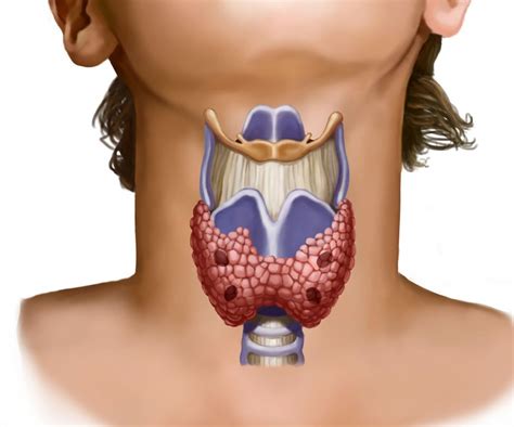 Thyroid nodules diagnosis. Thyroid nodules treatment. Must know