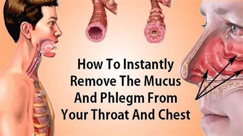 How To Eliminate Mucus And Phlegm From Your Throat And Chest (Instant ...