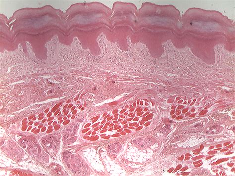 Tongue Histology Slide Labeled