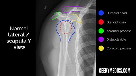 Shoulder X-ray Interpretation | Radiology | Geeky Medics