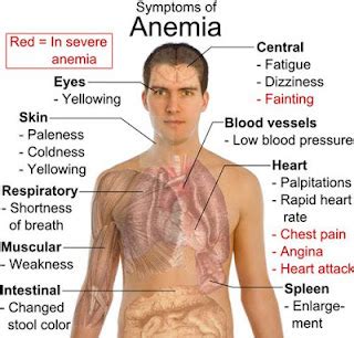 How to Cure Anemia Naturally