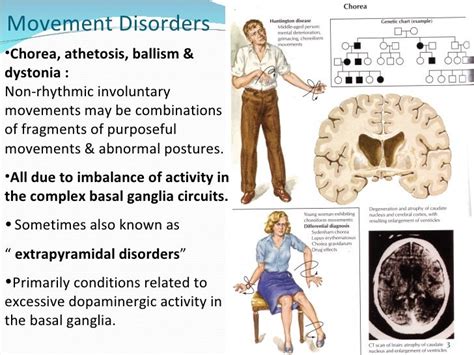 Movement disorders lecture