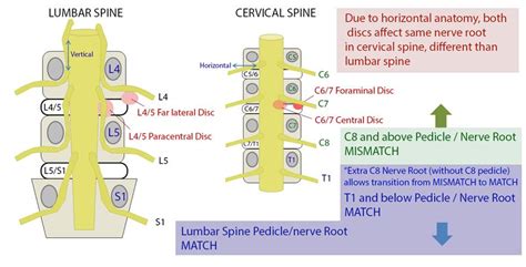 Neck & Upper Extremity Spine Exam - Spine - Orthobullets