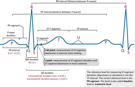 ECG interpretation: Characteristics of the normal ECG (P-wave, QRS ...