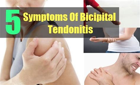 5 Symptoms Of Bicipital Tendonitis | Bicipital tendonitis, Tendinitis ...