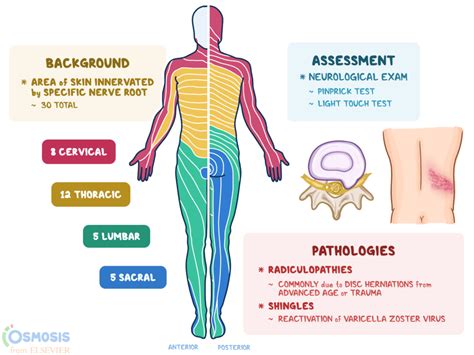 Thoracic Dermatomes Shingles - Dermatomes Chart and Map