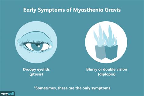 Myasthenia Gravis - 03 Symptoms, Causes & Complications