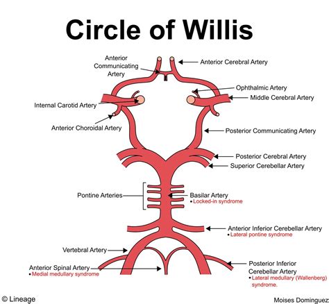 Circle of Willis - Neurology - Medbullets Step 1