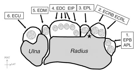 Image result for extensor retinaculum and wrist phones | Physical ...