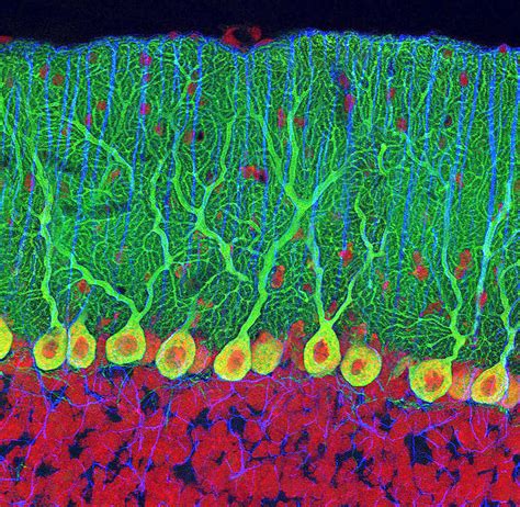 Purkinje Nerve Cells In The Cerebellum Photograph by Thomas Deerinck, Ncmir