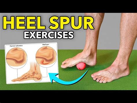 Heel Spur Exercises