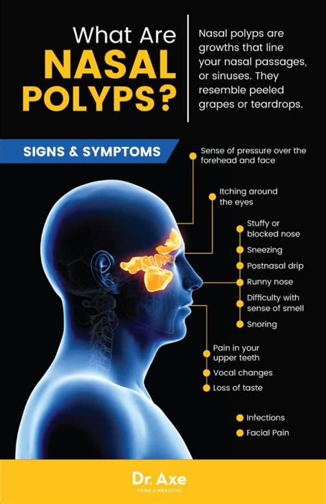 Do you have strange bumps inside your nose? If so, you may have nasal ...