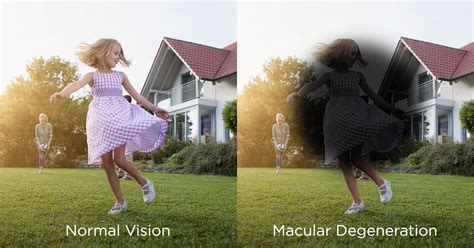 Protecting Your Vision From Age-Related Macular Degeneration - Malik ...