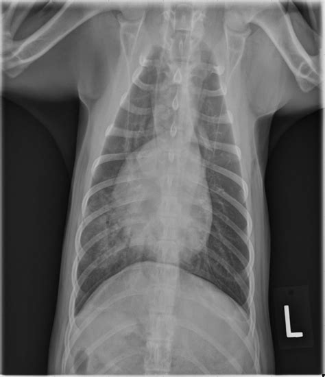 Meet the Patient – Radiology Rules