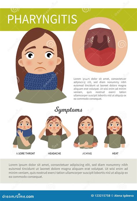 Pharyngitis Vector Illustration | CartoonDealer.com #29708128