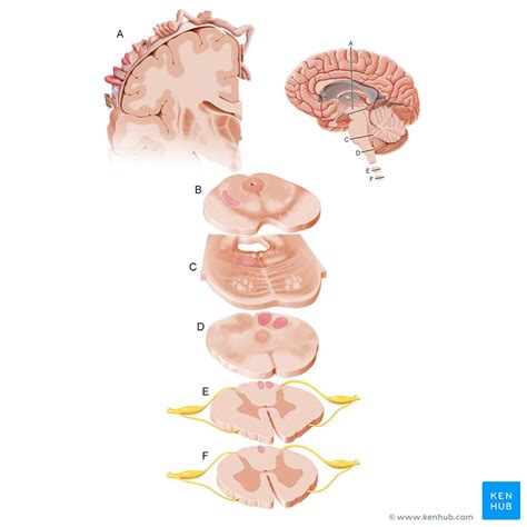 Extrapyramidal System Anatomy And Clinical Importance Kenhub