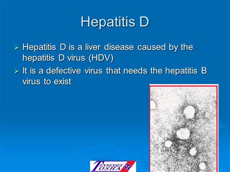 Hepatitis D Facts for Awareness