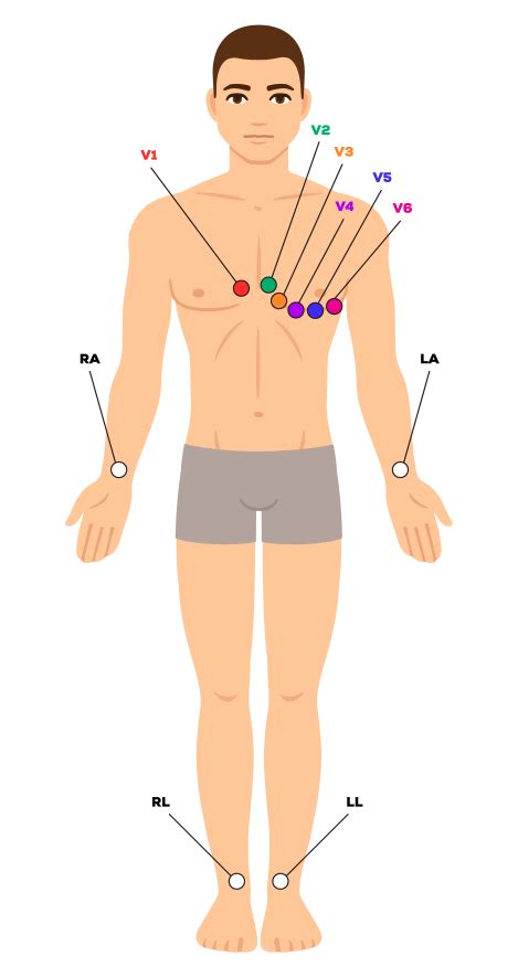 12 Lead Ecg Electrode Placement Diagram | Hot Sex Picture