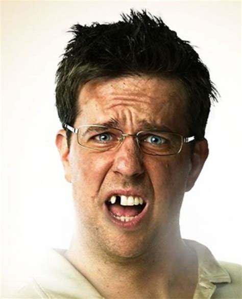 It Turned Out Ed Helms Really Was Missing A Tooth During The Scene In ...