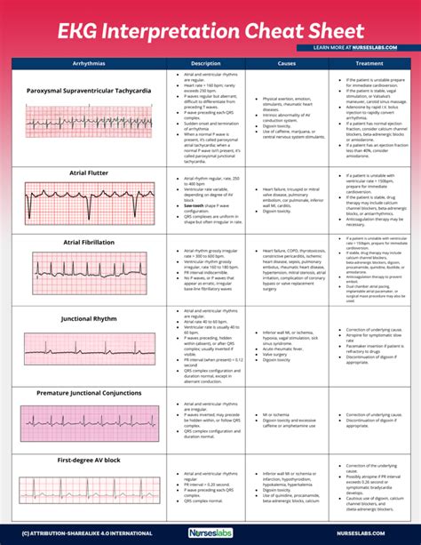 EKG Interpretation Cheat Sheet (Free Download) | Ekg interpretation ...