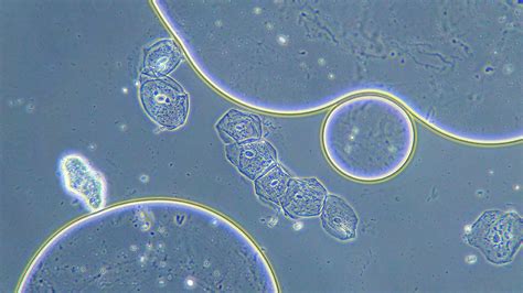 Phase Contrast – Martin Microscope