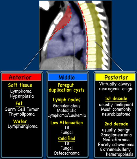 Anterior Mediastinum Anatomy