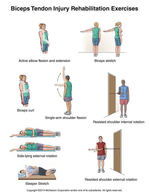 Summit Medical Group Bicep Tendonitis Exercises, Tendinitis, Elbow ...