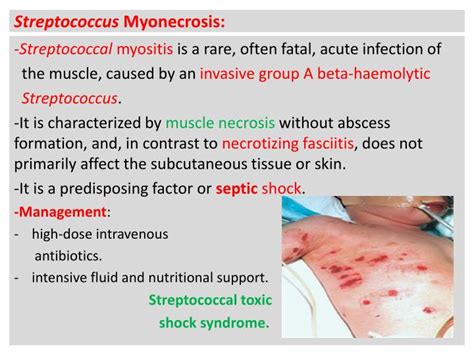 PPT - Infectious Myositis: PowerPoint Presentation - ID:1865298