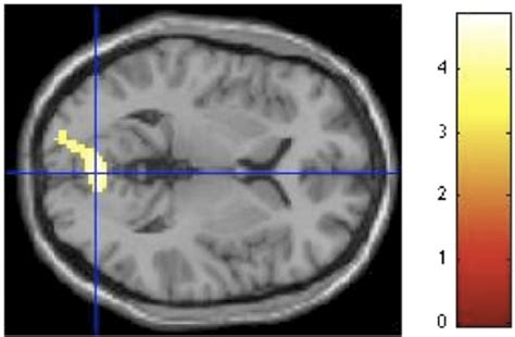 Curvilinear spaces activate the lingual gyrus and calcarine in ...