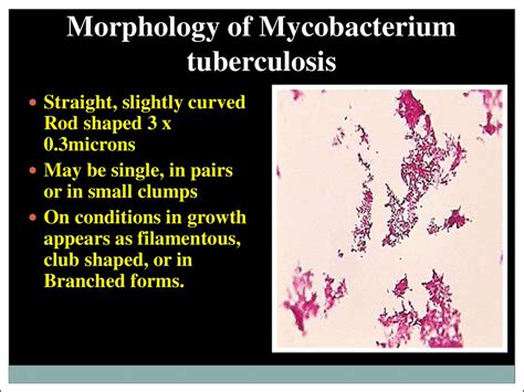 Importance of tuberculosis as scientific and practical problem ...