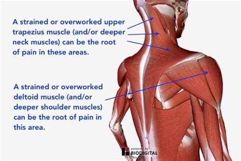 Understanding Shoulder Pain — Neuromuscular Therapy of Vermont