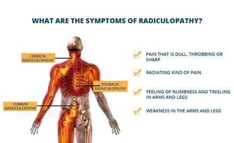 Can A Pinched Nerve Cause Tingling In Your Arm - Infoupdate.org