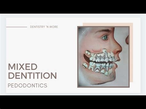 MIXED DENTITION PHASES - YouTube