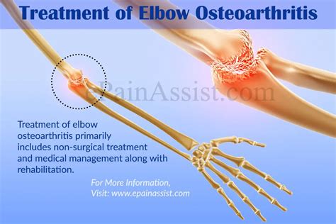 Elbow Osteoarthritis|Causes|Symptoms|Signs|Treatment|Surgery|Diagnosis