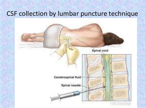 CSF Examination