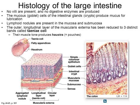 » Diverticulitis, Polyps, And Colon Cancer: What You Need To Understand ...